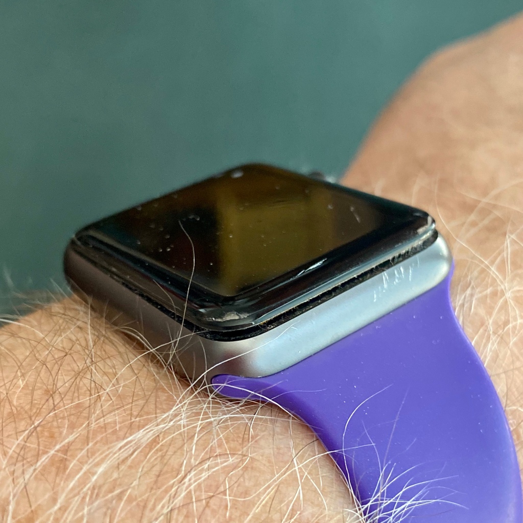 Apple Watch Series 1 on a wrist. The display is coming off of the case.